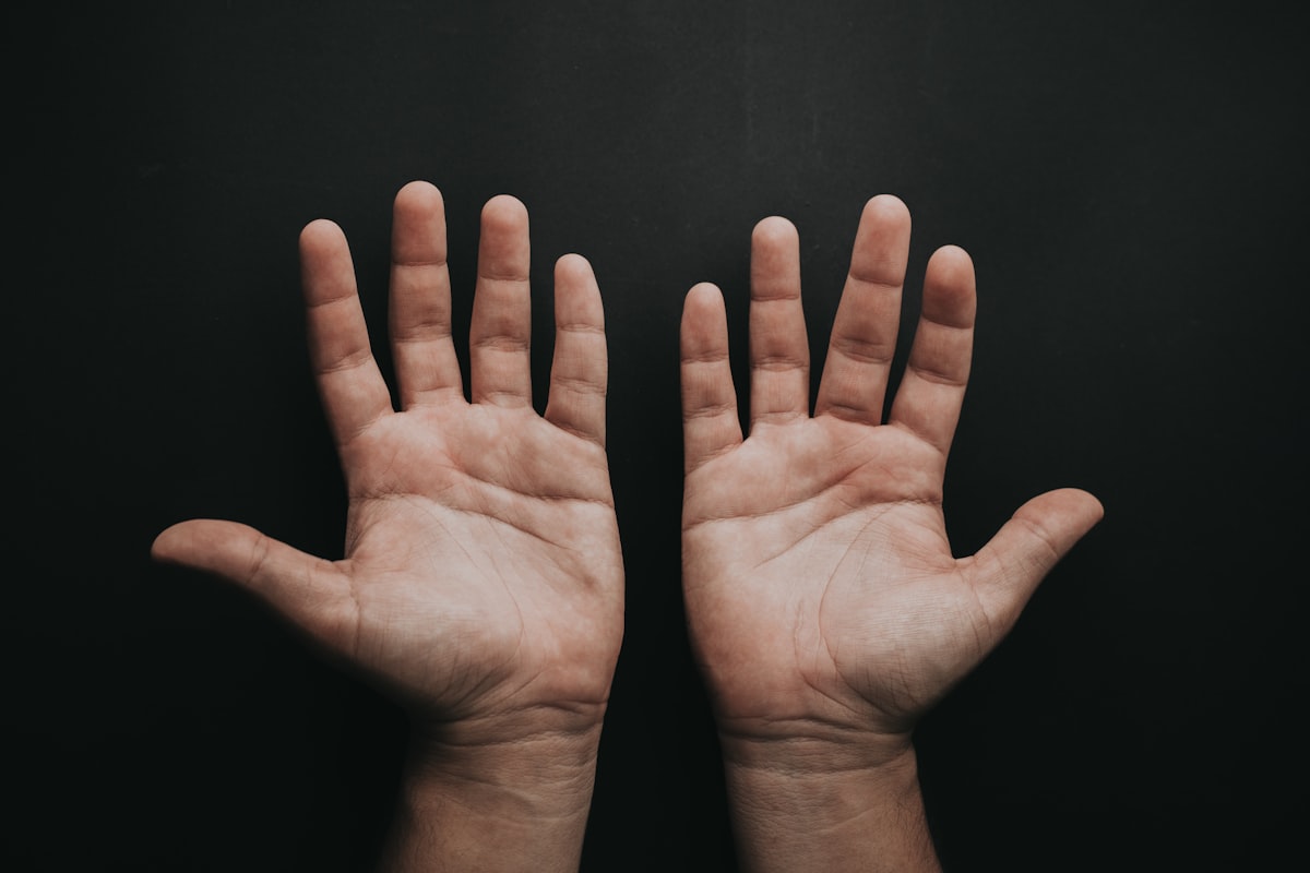 Illustration av domningar i händer